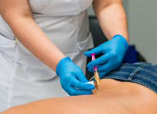 Trattamenti ozonoterapia Roma Trattamenti ozonoterapia Roma